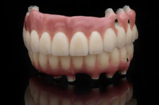 entire upper and lower prosthetic teeth