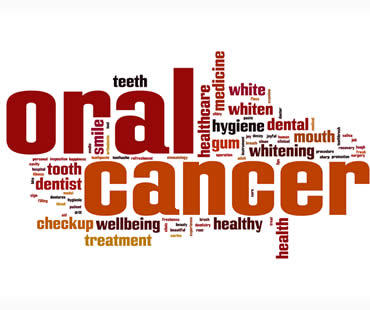 Oral Cancer Explained